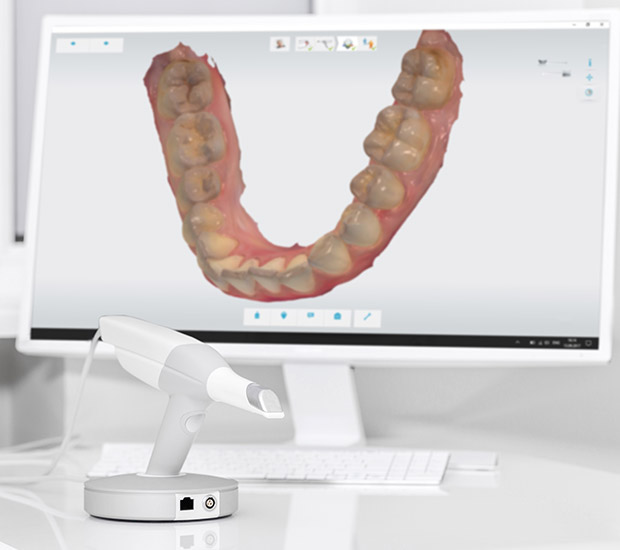 Philadelphia 3D Cone Beam and 3D Dental Scans